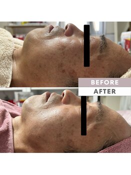 とぅるりん 肌質改善/ターンオーバー促進！！