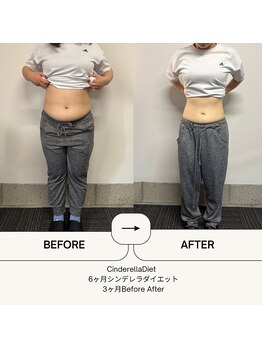 オーシャン整骨院(OCEAN整骨院)/6ヶ月コース