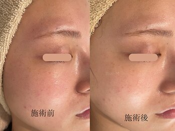 ブルーエム 大森(Blue-M)/