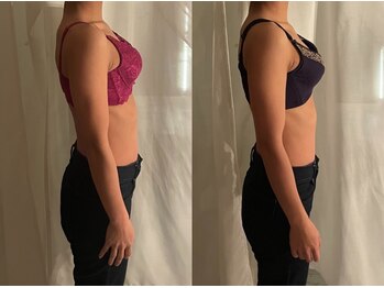 ハートランド(HEARTLAND)/変わるのはバストだけじゃない