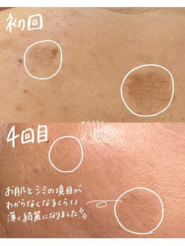 モッティ(MOTTY)/