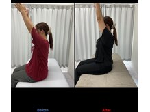 整体リアン 天神院(Lien)/ビフォーアフター：肩の可動域