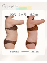 ジプソフィラ(Gypsophila)/色々なエステに通ったけれど...