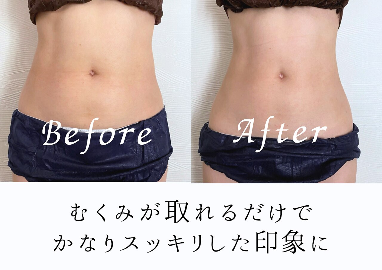 セルフィット 恵比寿店(cellfit)｜ホットペッパービューティー