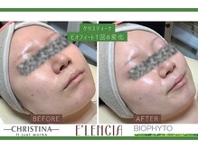 エレンシア(E'lencia)/クリスティーナ/ビオフィート