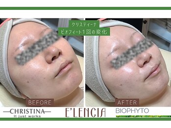 エレンシア(E'lencia)/クリスティーナ/ビオフィート