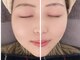 アンドグレイスプラス 恵比寿(&Grace+)の写真/医療提携の技術で小顔を目指す！一度で変化を実感しやすい特別なケアを体験♪