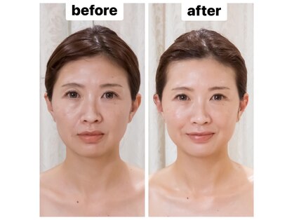 ハリツヤ(Hari艶)の写真