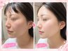 【赤みやくすみを撃退】 超美白！！感動の復元磁気パック 19800→8800