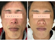 シュウ(Shuu)/男性のお客様のビフォーアフター