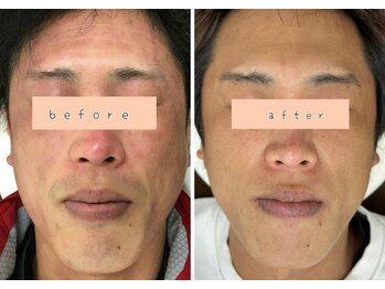 シュウ(Shuu)/男性のお客様のビフォーアフター