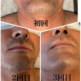 シェルビー(SHELBY)