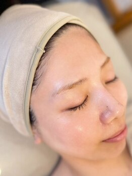 彌庵の写真/【最新プラズマケア】でシミ・くすみ一掃！肌荒れも改善し、透き通る素肌へ！