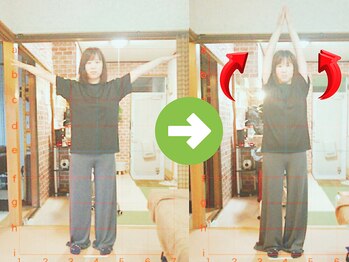 サプライズ整体院/30代ママさんの肩こり初回結果