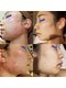 サラ(SARA)の写真/フェイスラインのもたつき・二重アゴ・エラ張りを徹底ケア!コリを流し脂肪分解でキュッと引き締まる小顔へ