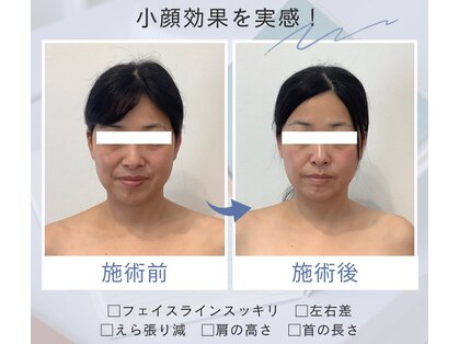 りもあず(ReMore-S)の写真