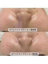 グラン ジュテ/LHALALA &nbsp;泡洗顔