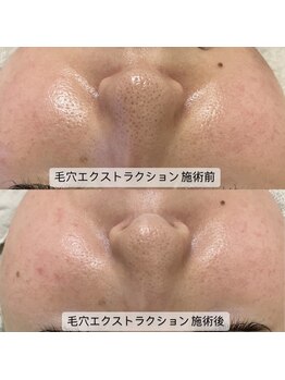 グラン ジュテ/LHALALA &nbsp;泡洗顔