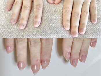 ニコワイズネイル(Nico Y's Nail)の写真/自爪育成が得意なサロン。長年の経験知識と独自のケアメソッドであなたの爪悩みに寄り添います。