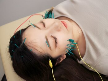 にしもと整骨院 鍼灸院 福島院/EMS美容鍼