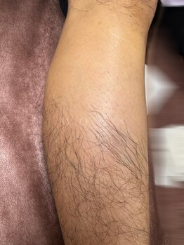 ムーン 横浜(MOON)/【膝下】