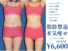 ピュアノア 三木店