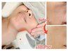 エイジングのお悩みに光小顔(二重アゴ/浮腫み/たるみ)×韓国最上級ケア80分