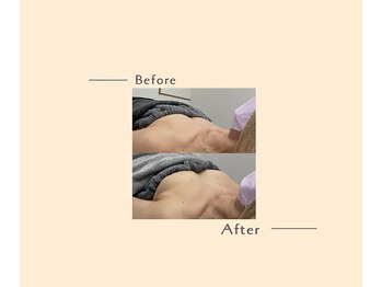 オベリオ(OBERIO)/