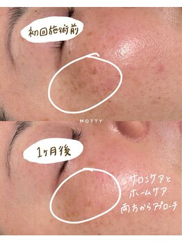 モッティ(MOTTY)/