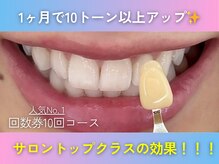 ホワイトニングショップ 奈良香芝店(Whitening shop)