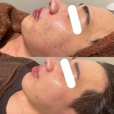 ブプラ 小田原店(BUPURA)