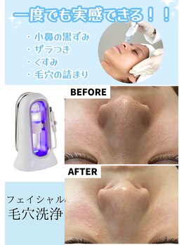 ミルトゥ(myrte)/【フェイシャル毛穴洗浄】