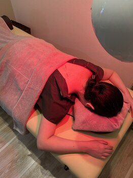 ヒトハリ鍼灸整体院(HITOHARI鍼灸整体院)/首肩こり鍼灸