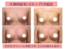 ラヴィス(ravis)の雰囲気（口コミ5.0の実力派サロン！小胸/下垂/左右差に悩む方も多数変化）