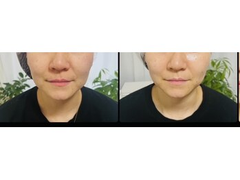 サロンモコ(Salon Moco)/