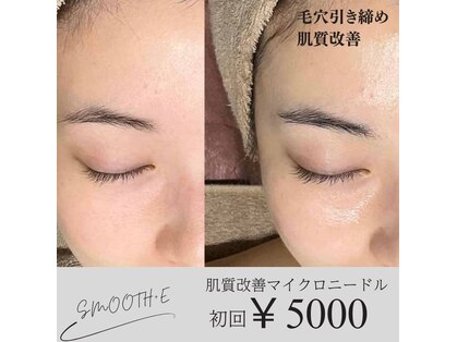 スムース イー(Smooth+E)の写真