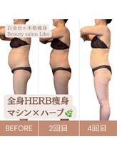 リコ 白金台(Liko)/全身ハーブ痩身　BeforeAfter