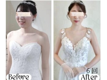 蒼(so)の写真/花嫁様必見！『エラ&肩ボト』より、効く！360度写真映え抜群の匠の全身＋小顔矯正。華奢肩&細長首&美横顔に