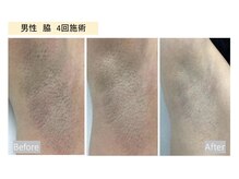 チェリーブロッサム 上福岡店(CHERRY BLOSSOM)/