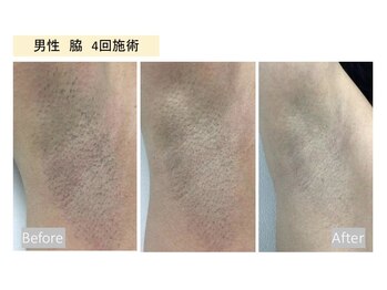 チェリーブロッサム 上福岡店(CHERRY BLOSSOM)/