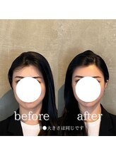 コア 心斎橋 堀江店(koa)/お客様ビフォーアフター