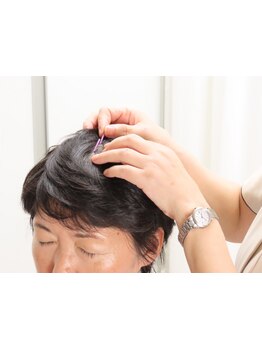 鍼灸施術を受けたい