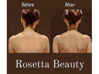 ロゼッタビューティー(Rosetta Beauty)/ビフォーアフター写真で効果確認