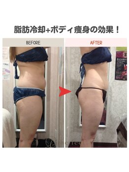 ビーフィール 府中店(be feel)/お腹の頑固な脂肪もお任せ！