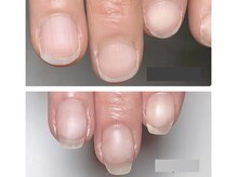 ネイルアートルーム ハコ(HACO)の雰囲気（トラブルネイルや爪のお悩みに対応）