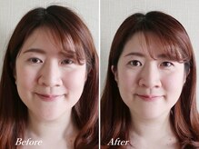 ドクターボディ 新宿店(Dr.Body)/【たるみ/むくみ/小顔　30代】