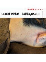 美々庵/LED脱毛＊うなじ