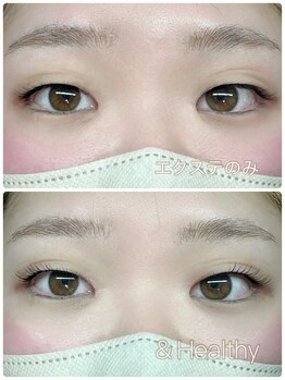 ジズ(zizz)/&Healthyで理想のデザインに