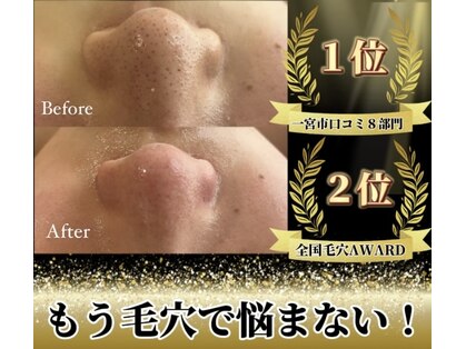 レーヌ(Reine)の写真