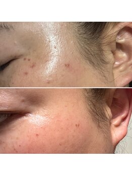 アルディート(Ardito)/シミケア